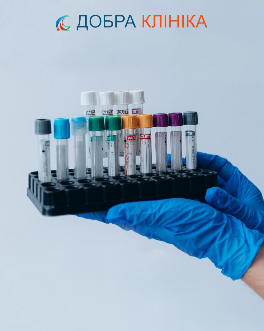 Акція в Медичному центрі Добра Клініка на аналізи знижка -20%