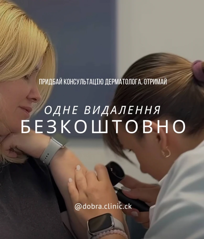 Акція медичного центру «Добра Клініка» Видалення безкоштовно